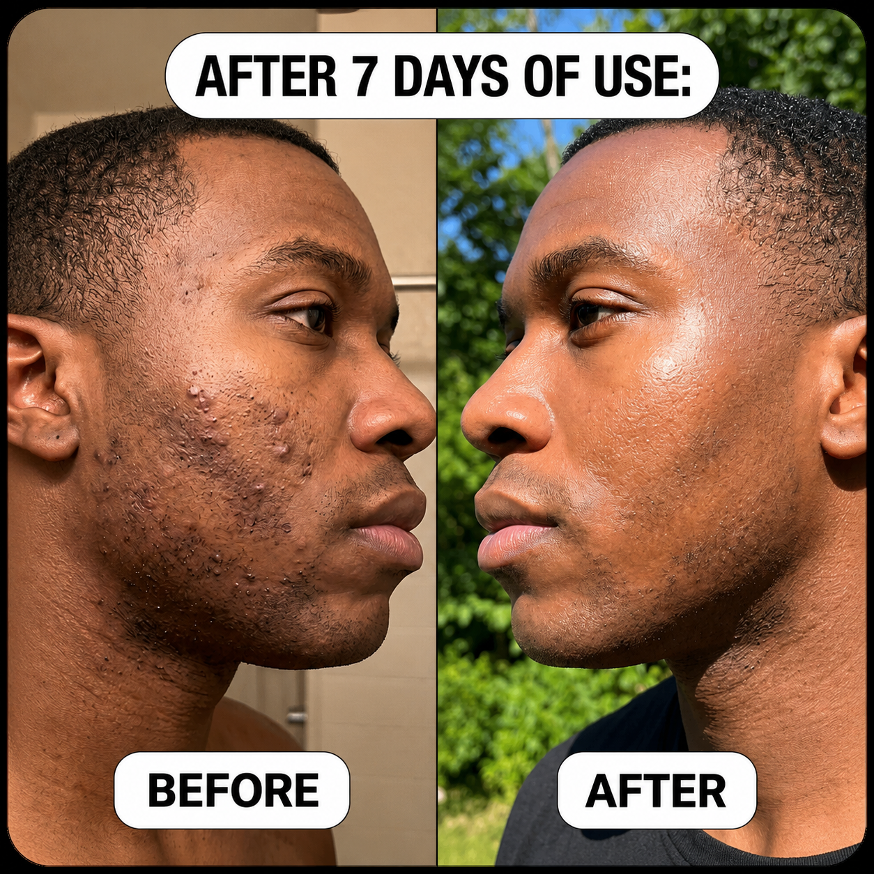 Natorwell™ Bump Relief & Soothing