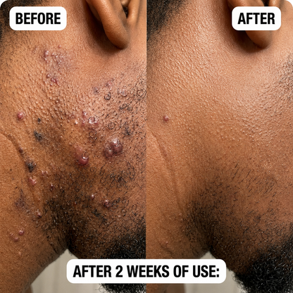 Natorwell™ Bump Relief & Soothing